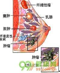 健康乳房图片,揭秘完美胸型的秘密